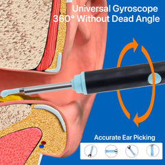 Ear Cleaning Machine